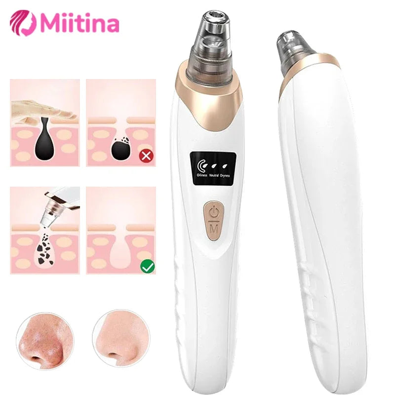 USB Electric Blackhead Removal Vacuum with Suction - Facial Pore Cleaner for Acne and Pimple Extraction