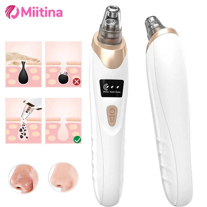 USB Electric Blackhead Removal Vacuum with Suction - Facial Pore Cleaner for Acne and Pimple Extraction